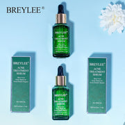 BREYLEE Acne Treatment Face Serum Mask Anti Acne Pimple Scar Remover Moisturizing Whitening Skin Care Facial Essence Cream 17ml